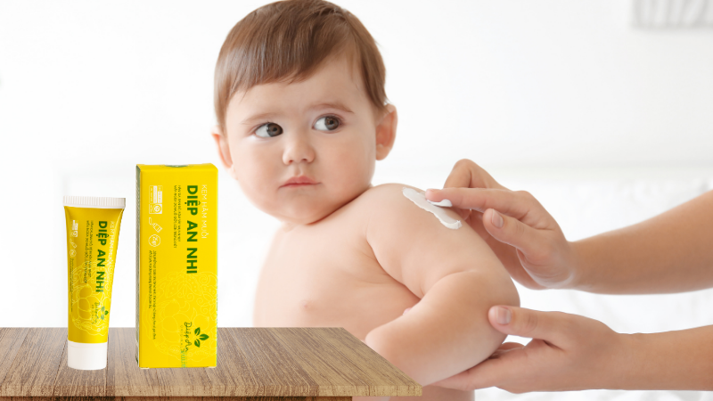 Có nên dùng kem hăm muỗi Diệp An Nhi cho trẻ sơ sinh?