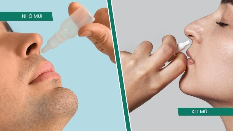 Phân biệt nhỏ mũi và xịt mũi: dạng bào chế nào thấm sâu & hiệu quả hơn?